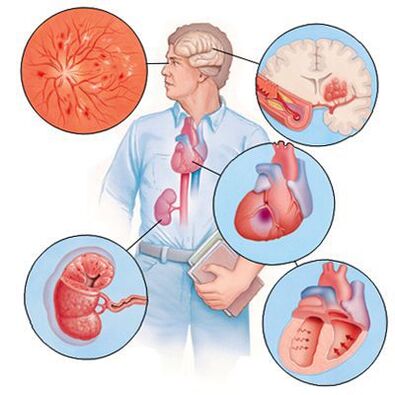 Cardiol prevents the development of comorbidities